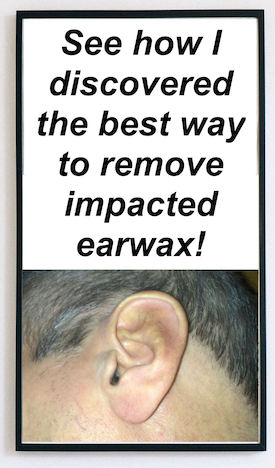 Earwax-Removal