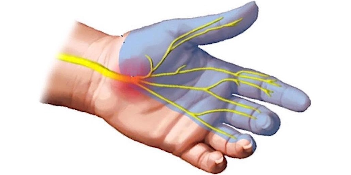 The median nerve goes through the carpal tunnel.