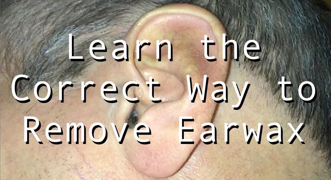 Learn how to remove earwax safely and successfully.