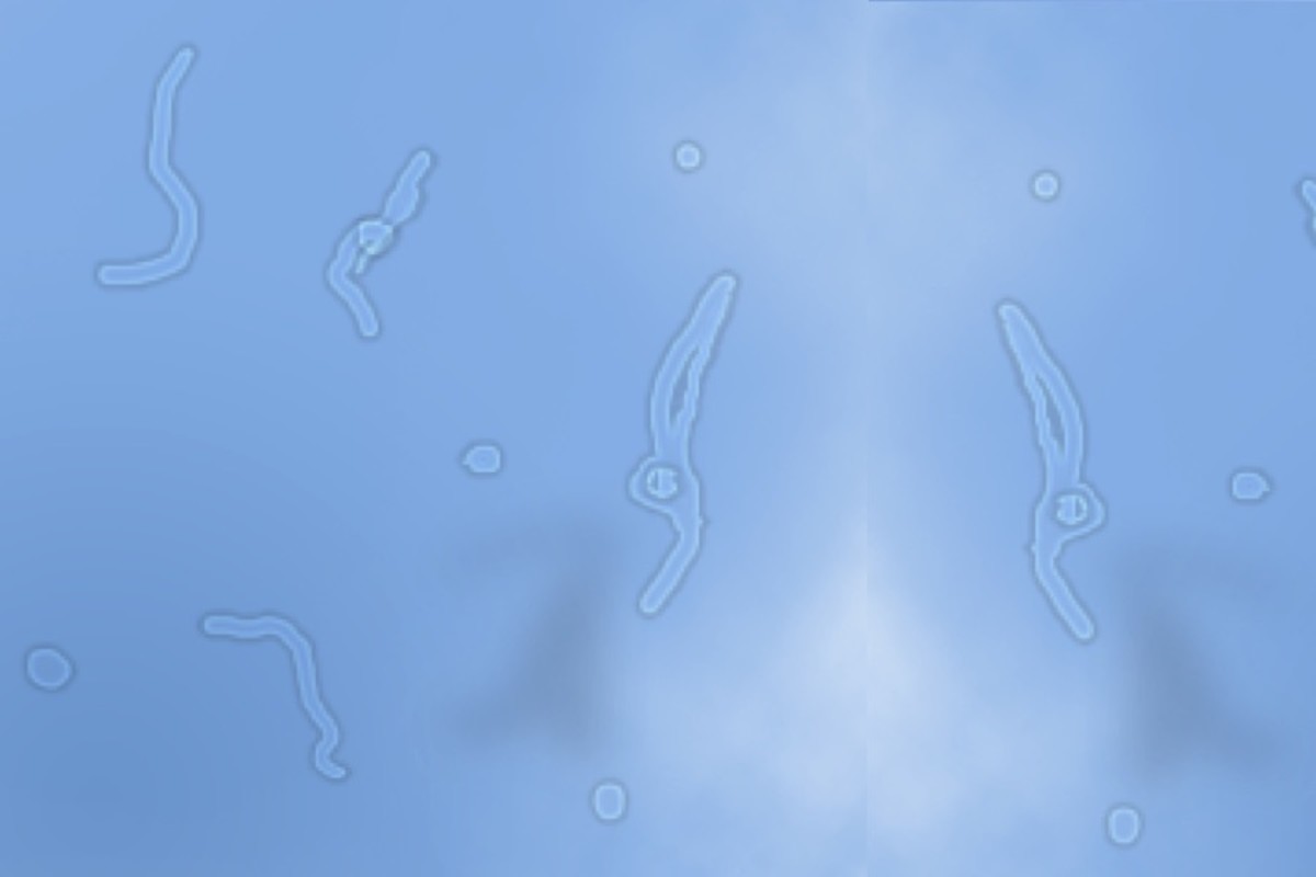 Example of eye floaters