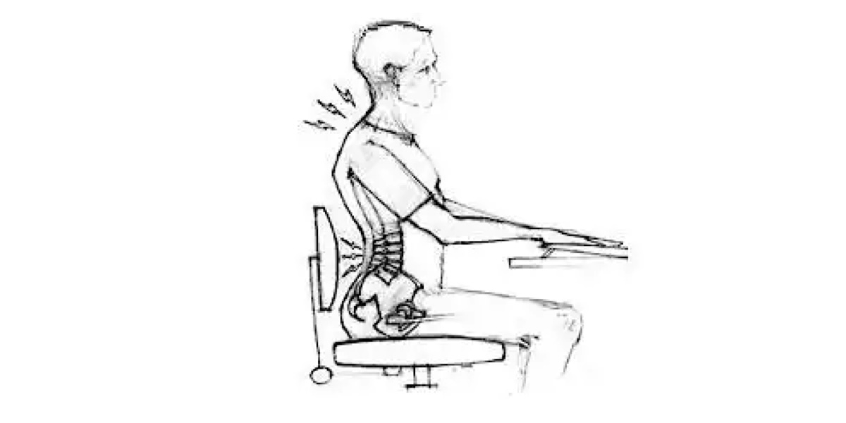 Drawing showing herniated discs in neck.